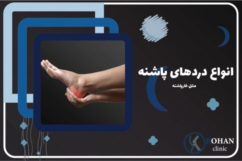 خارپاشنه و درد کف پا