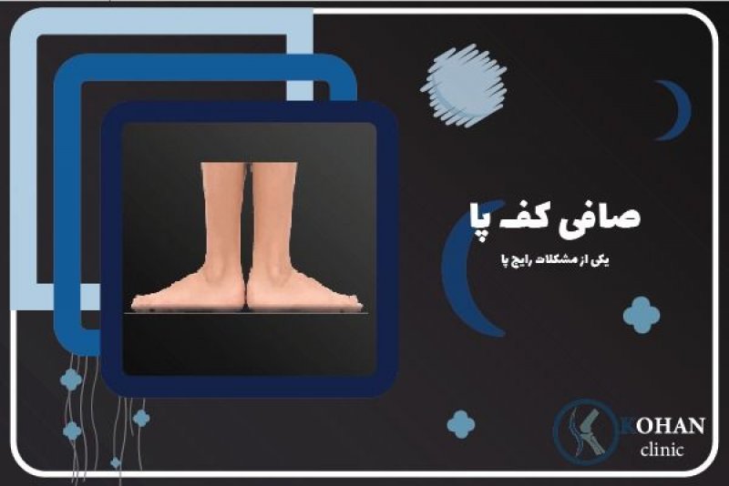 صافی کف پا
